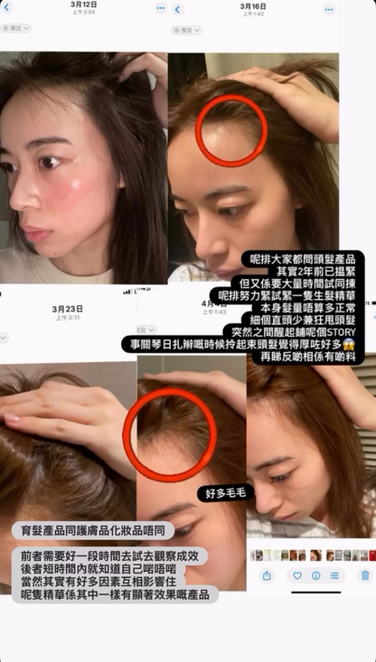 德國激活生髮精華液￼
