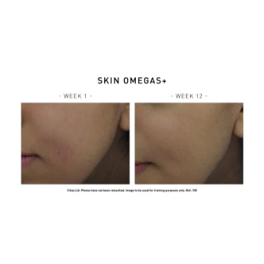 【美肌抗皺】套裝 Glowing Skin & Anti-Wrinkle Set